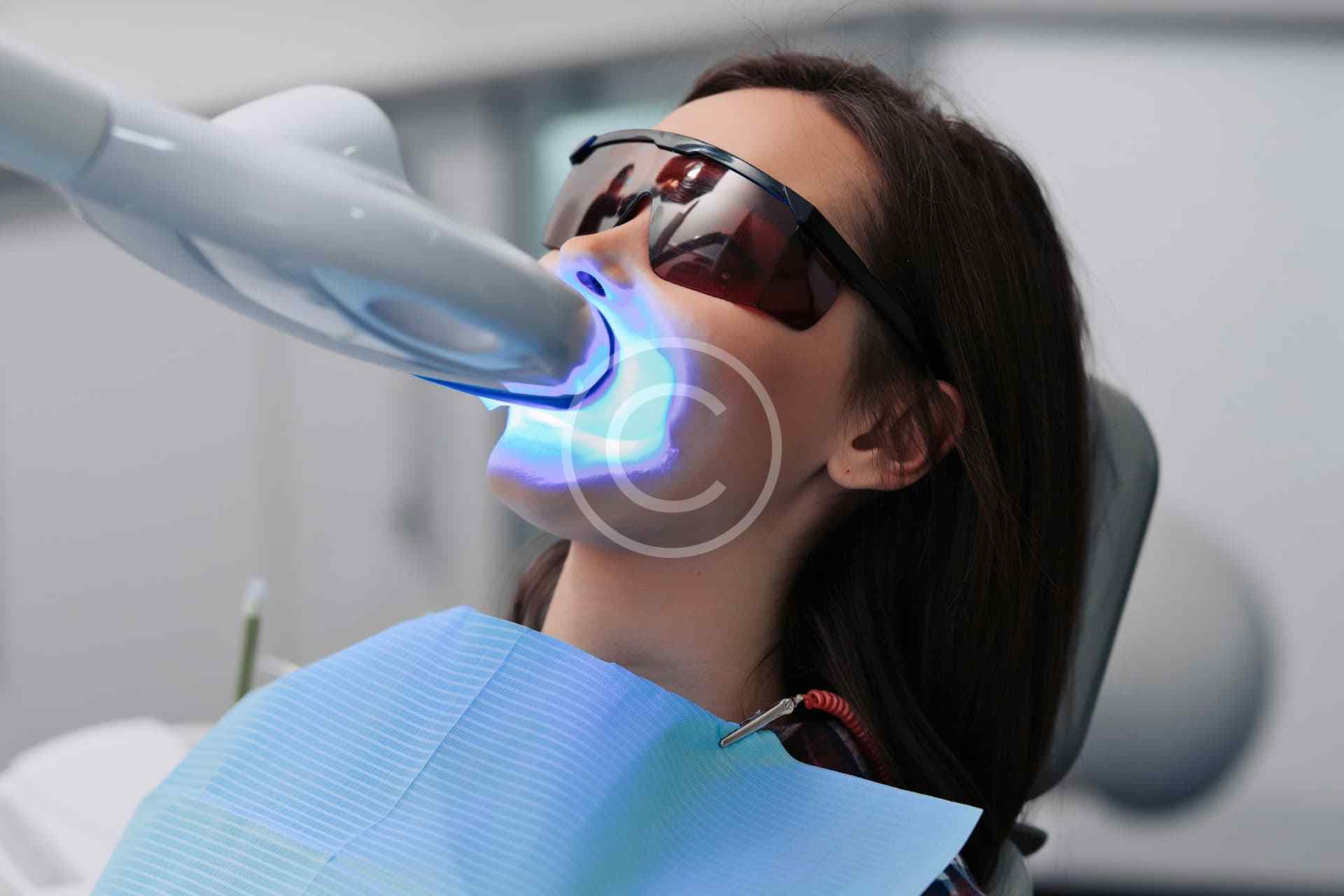 Laser whitening